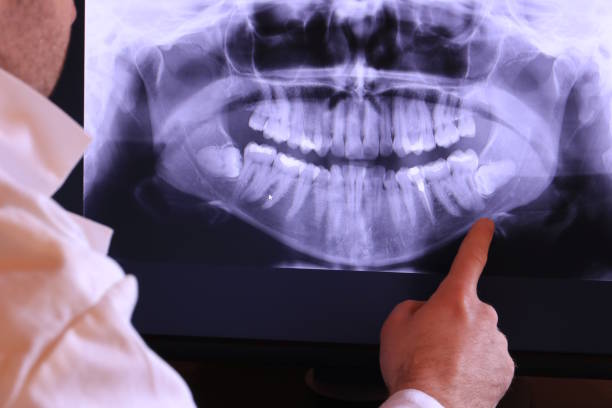 Best Emergency Tooth Extraction in Union Point, GA