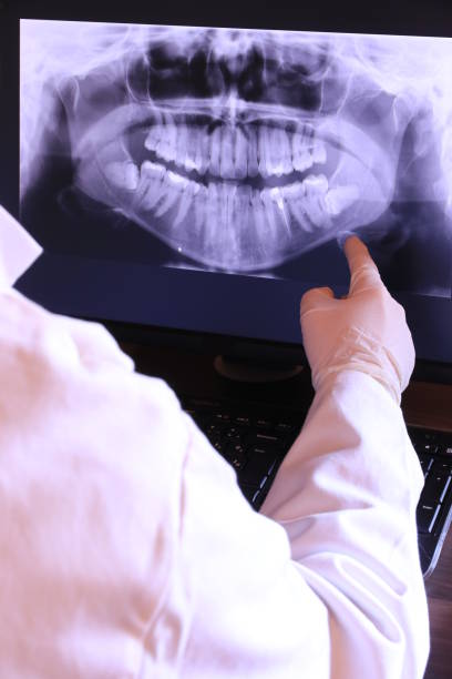Best Emergency Tooth Extraction in Union Point, GA