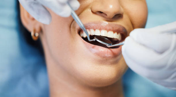 Best Emergency Broken Tooth Repair in Union Point, GA