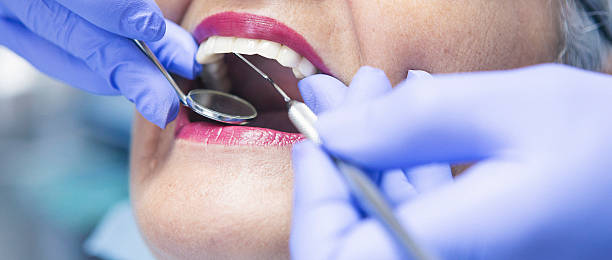 Best Emergency Tooth Extraction in Union Point, GA